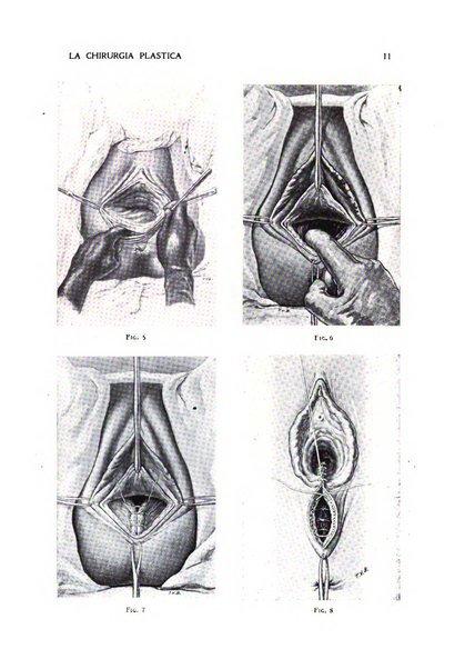 La chirurgia plastica rivista della Societa italiana di chirurgia riparatrice plastica ed estetica