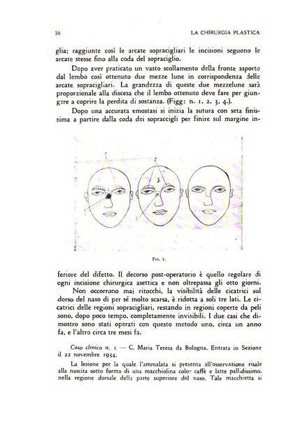 La chirurgia plastica rivista della Societa italiana di chirurgia riparatrice plastica ed estetica