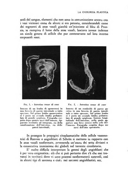 La chirurgia plastica rivista della Societa italiana di chirurgia riparatrice plastica ed estetica