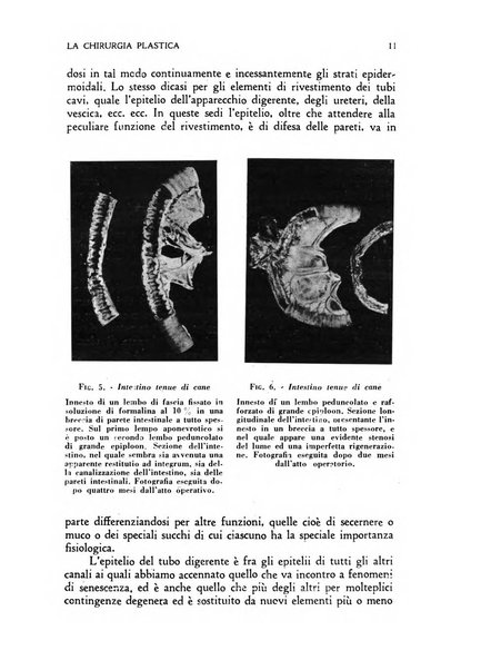 La chirurgia plastica rivista della Societa italiana di chirurgia riparatrice plastica ed estetica