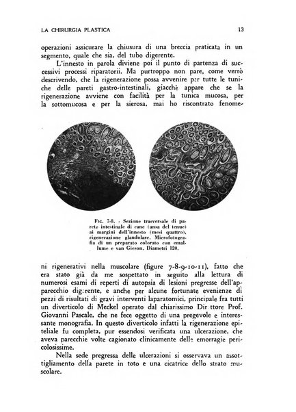 La chirurgia plastica rivista della Societa italiana di chirurgia riparatrice plastica ed estetica