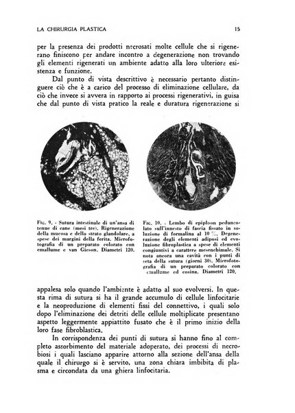 La chirurgia plastica rivista della Societa italiana di chirurgia riparatrice plastica ed estetica