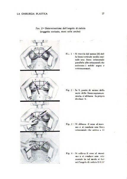 La chirurgia plastica rivista della Societa italiana di chirurgia riparatrice plastica ed estetica