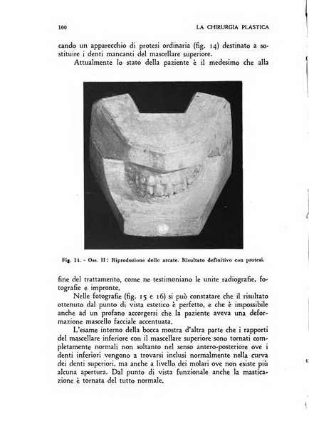 La chirurgia plastica rivista della Societa italiana di chirurgia riparatrice plastica ed estetica