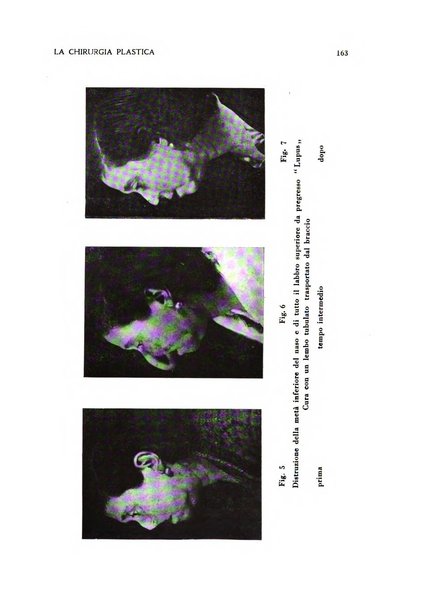La chirurgia plastica rivista della Societa italiana di chirurgia riparatrice plastica ed estetica