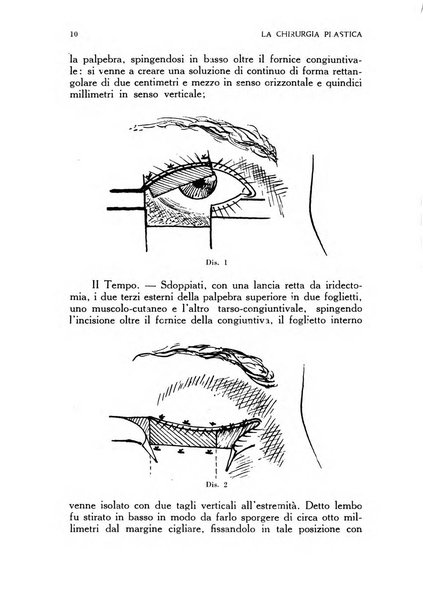 La chirurgia plastica rivista della Societa italiana di chirurgia riparatrice plastica ed estetica