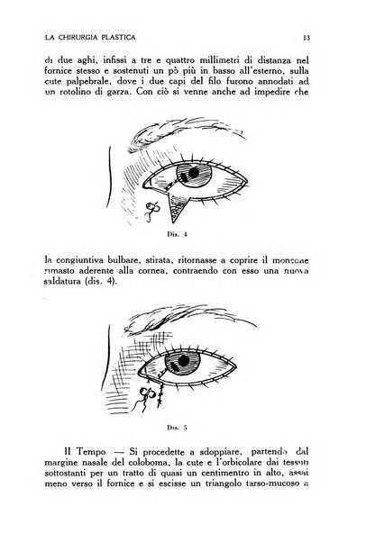 La chirurgia plastica rivista della Societa italiana di chirurgia riparatrice plastica ed estetica