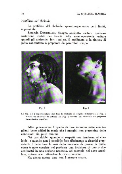 La chirurgia plastica rivista della Societa italiana di chirurgia riparatrice plastica ed estetica