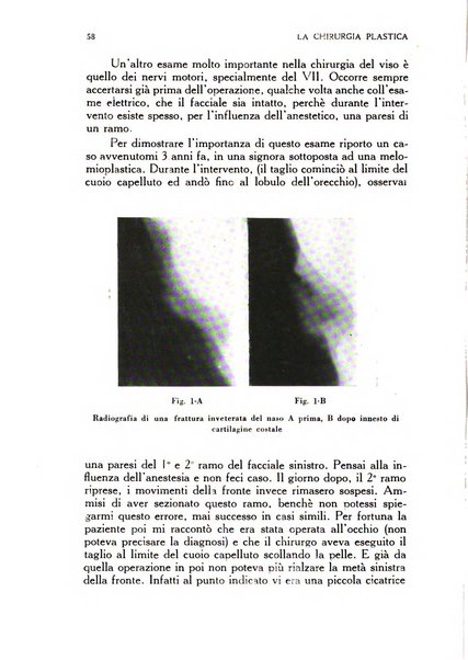 La chirurgia plastica rivista della Societa italiana di chirurgia riparatrice plastica ed estetica