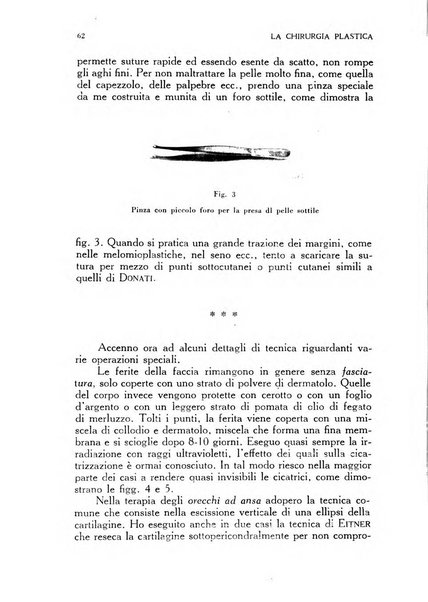 La chirurgia plastica rivista della Societa italiana di chirurgia riparatrice plastica ed estetica