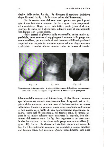 La chirurgia plastica rivista della Societa italiana di chirurgia riparatrice plastica ed estetica