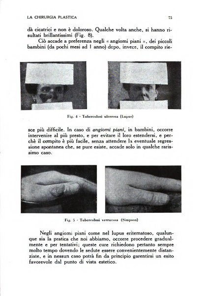 La chirurgia plastica rivista della Societa italiana di chirurgia riparatrice plastica ed estetica