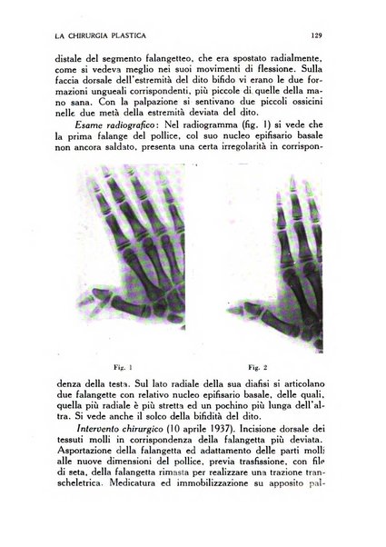 La chirurgia plastica rivista della Societa italiana di chirurgia riparatrice plastica ed estetica