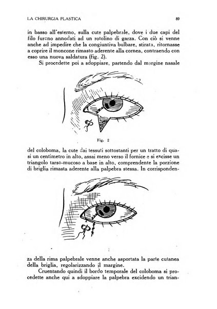 La chirurgia plastica rivista della Societa italiana di chirurgia riparatrice plastica ed estetica