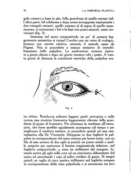 La chirurgia plastica rivista della Societa italiana di chirurgia riparatrice plastica ed estetica