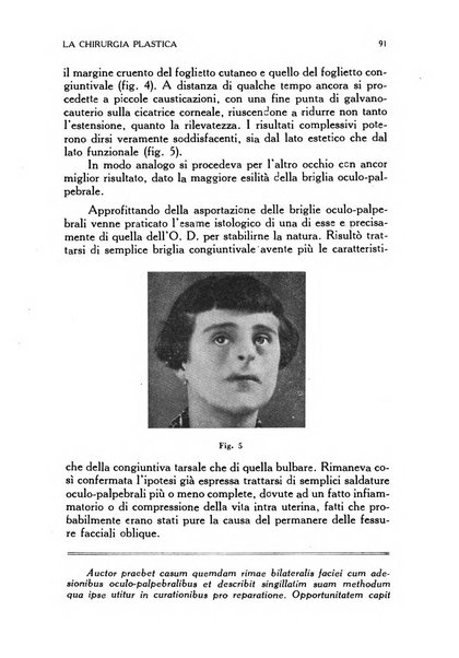 La chirurgia plastica rivista della Societa italiana di chirurgia riparatrice plastica ed estetica