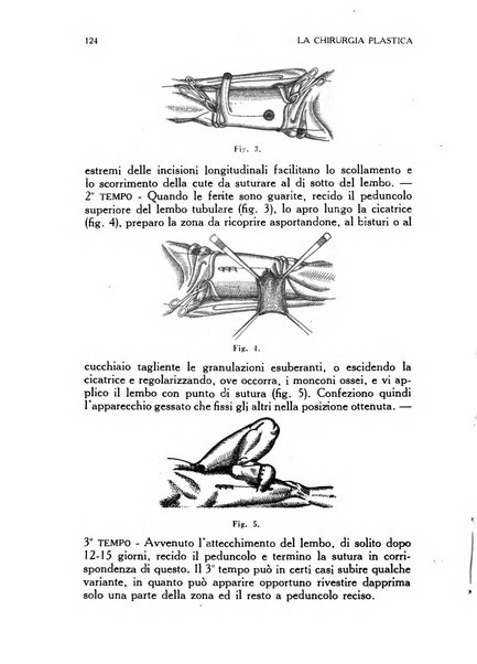 La chirurgia plastica rivista della Societa italiana di chirurgia riparatrice plastica ed estetica