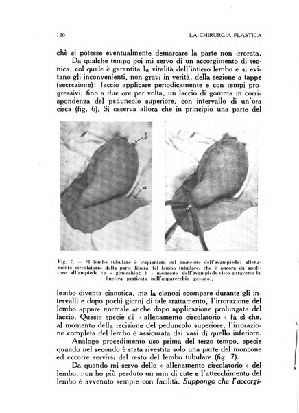 La chirurgia plastica rivista della Societa italiana di chirurgia riparatrice plastica ed estetica