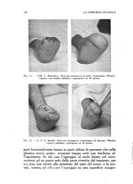 La chirurgia plastica rivista della Societa italiana di chirurgia riparatrice plastica ed estetica