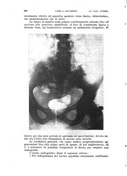 La clinica ostetrica e ginecologica rivista mensile per i medici pratici