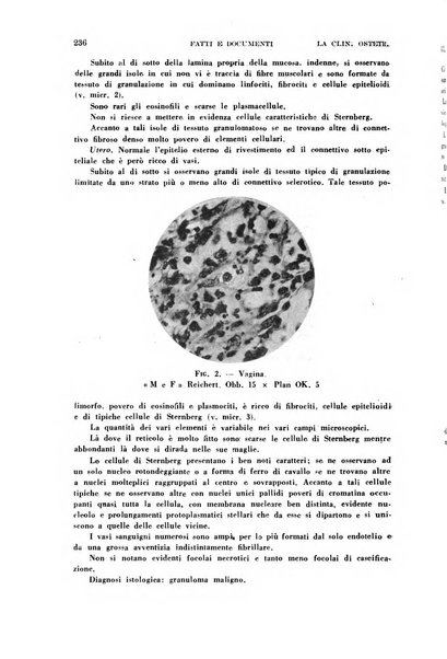 La clinica ostetrica e ginecologica rivista mensile per i medici pratici