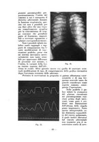 giornale/RML0027517/1933/unico/00000094