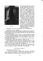 giornale/RML0027517/1933/unico/00000265