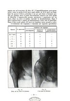 giornale/RML0027517/1933/unico/00000415