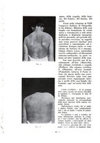 giornale/RML0027517/1934/unico/00000074