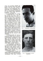 giornale/RML0027517/1934/unico/00000155