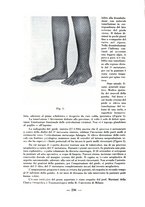 giornale/RML0027517/1937/unico/00000248