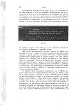 giornale/RML0028669/1918/V.2/00000292