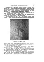 giornale/RML0030840/1930/unico/00000581