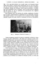 giornale/RML0031005/1935/unico/00000191