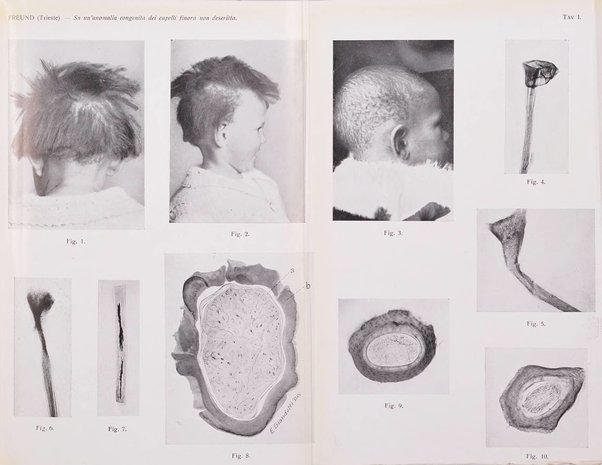 Giornale italiano di dermatologia e sifilologia