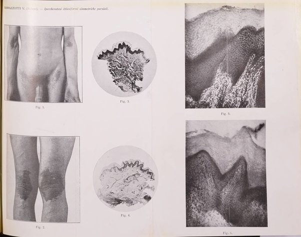 Giornale italiano di dermatologia e sifilologia