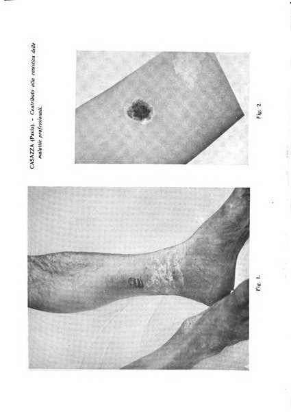 Giornale italiano di dermatologia e sifilologia