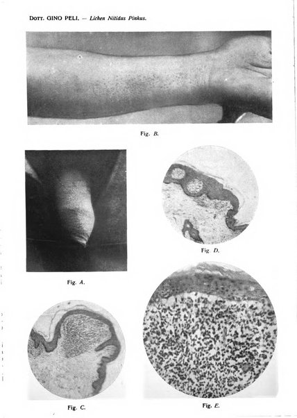 Giornale italiano di dermatologia e sifilologia