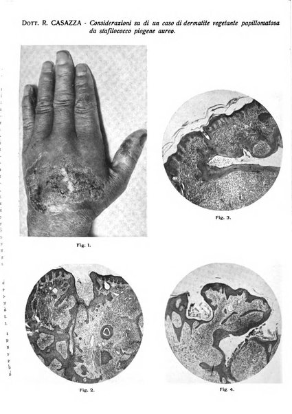 Giornale italiano di dermatologia e sifilologia