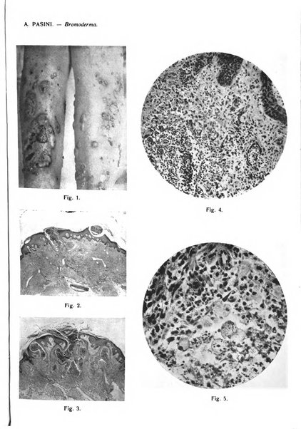 Giornale italiano di dermatologia e sifilologia