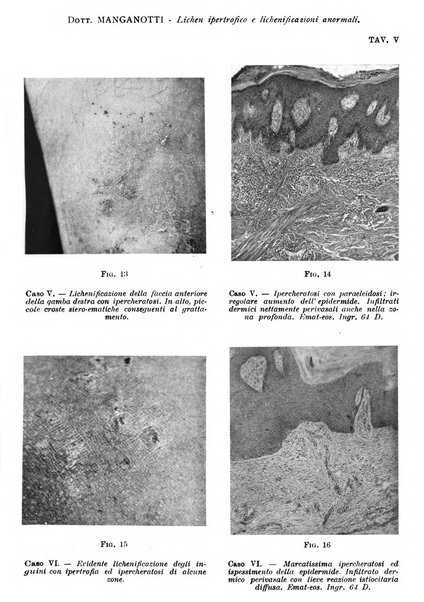 Giornale italiano di dermatologia e sifilologia