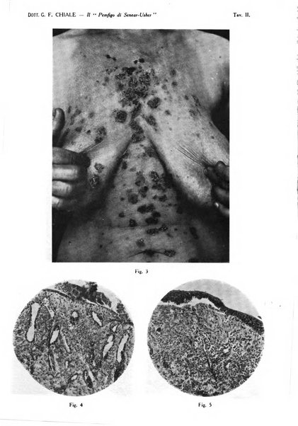 Giornale italiano di dermatologia e sifilologia