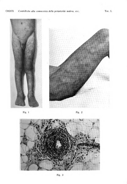 Giornale italiano di dermatologia e sifilologia