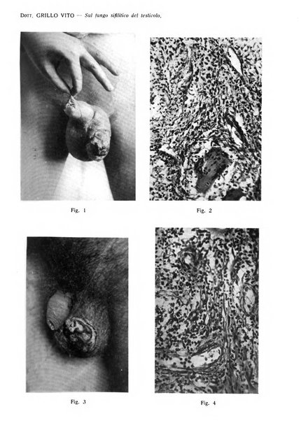 Giornale italiano di dermatologia e sifilologia