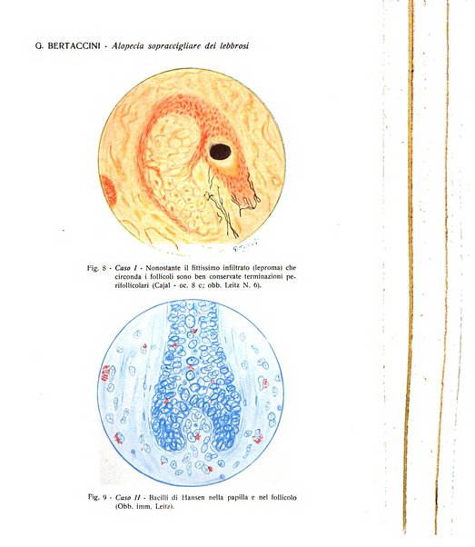 Giornale italiano di dermatologia e sifilologia