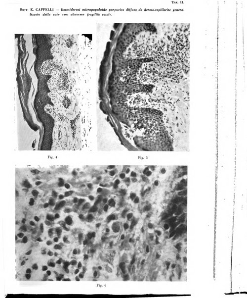 Giornale italiano di dermatologia e sifilologia