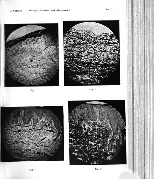 Giornale italiano di dermatologia e sifilologia