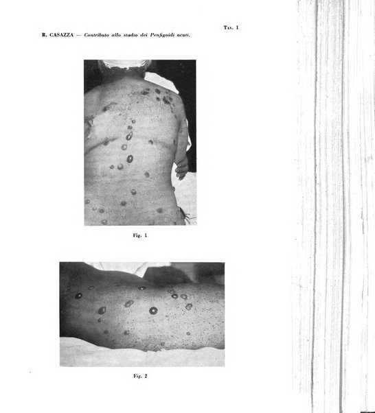 Giornale italiano di dermatologia e sifilologia