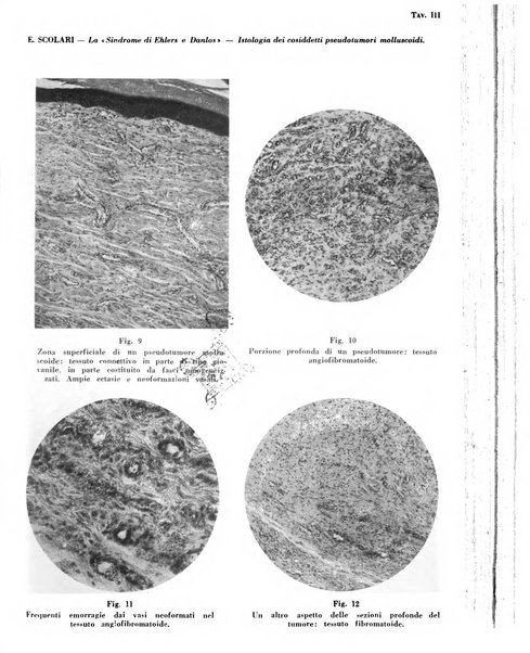 Giornale italiano di dermatologia e sifilologia