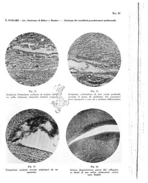 Giornale italiano di dermatologia e sifilologia